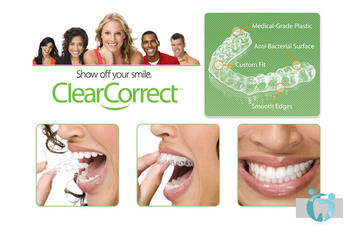 Clear Tray Orthodontics